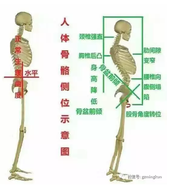 骨盆修复的原理_仪器骨盆修复和徒手的哪个更适合 看完这篇文章你就知道了